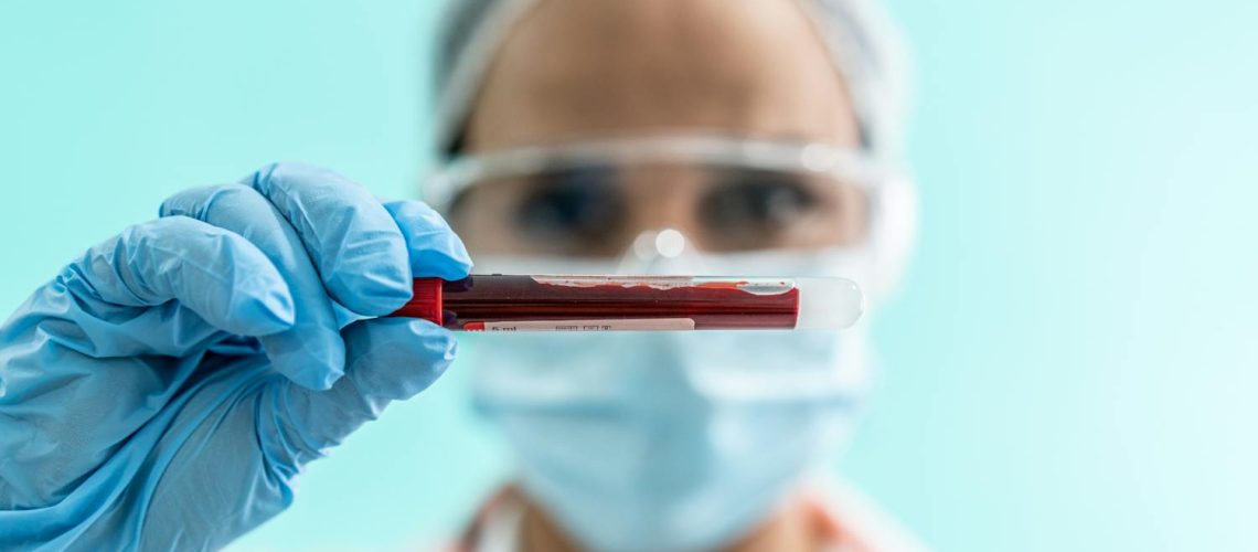 Qu'est-ce que la TCMH et comment interpréter cette valeur ?